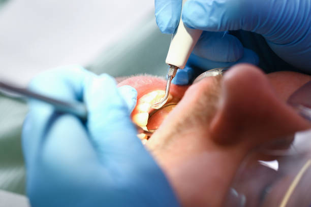 Best Emergency Gum Treatment in Walton Hills, OH